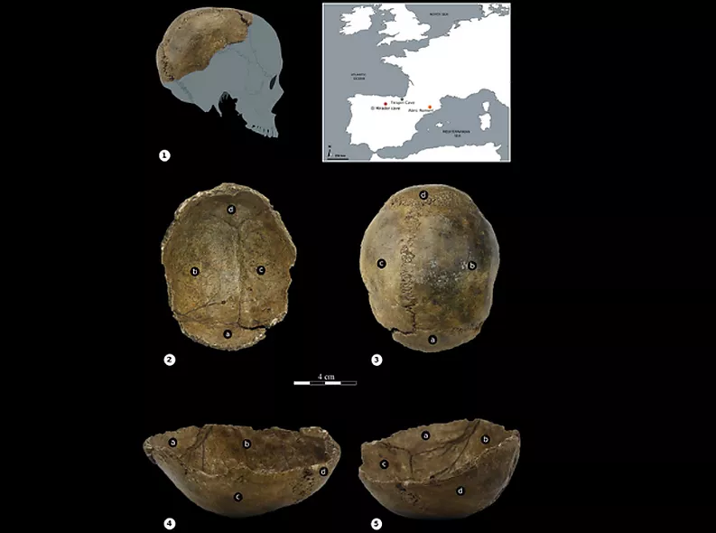 The application of advanced computing techniques revolutionizes the study of cranial fractures in archaeology